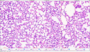 Fibrosis model image 1